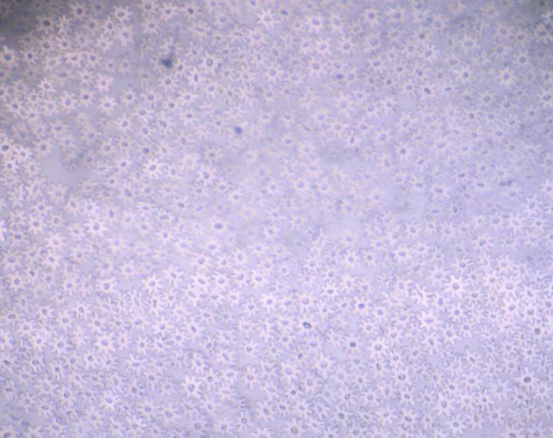 Opportunity knocks for Teijin with new spun yarn                                                                                                                                                        